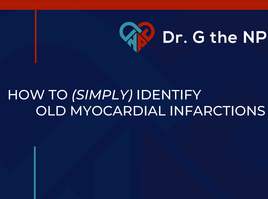 How to (Simply) Identify Old Myocardial Infarctions Guide